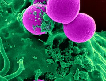 calprotectina globuli bianchi neutrofili sangue microbiologia