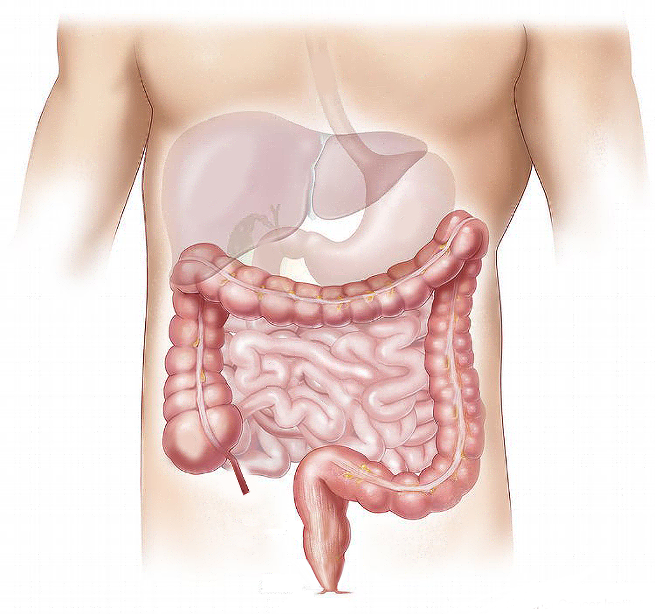 intestino - occlusione intestinale