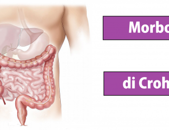 Morbo di Crohn - Malattia di Crohn - tipi di malattia di Crohn